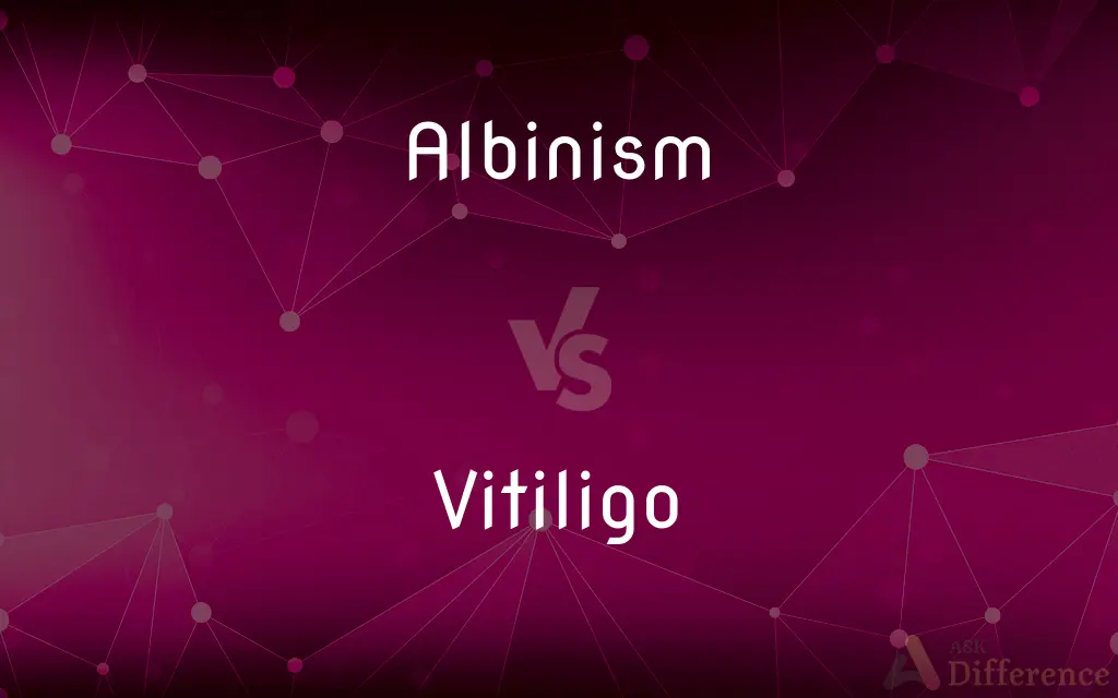 Albinism vs. Vitiligo — What's the Difference?