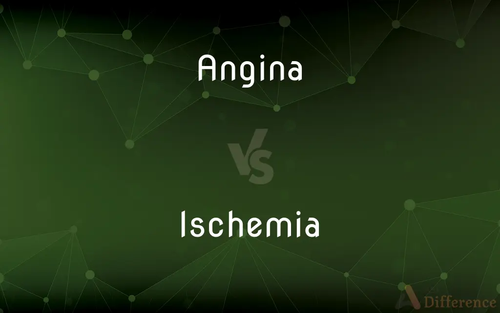 Angina vs. Ischemia — What's the Difference?