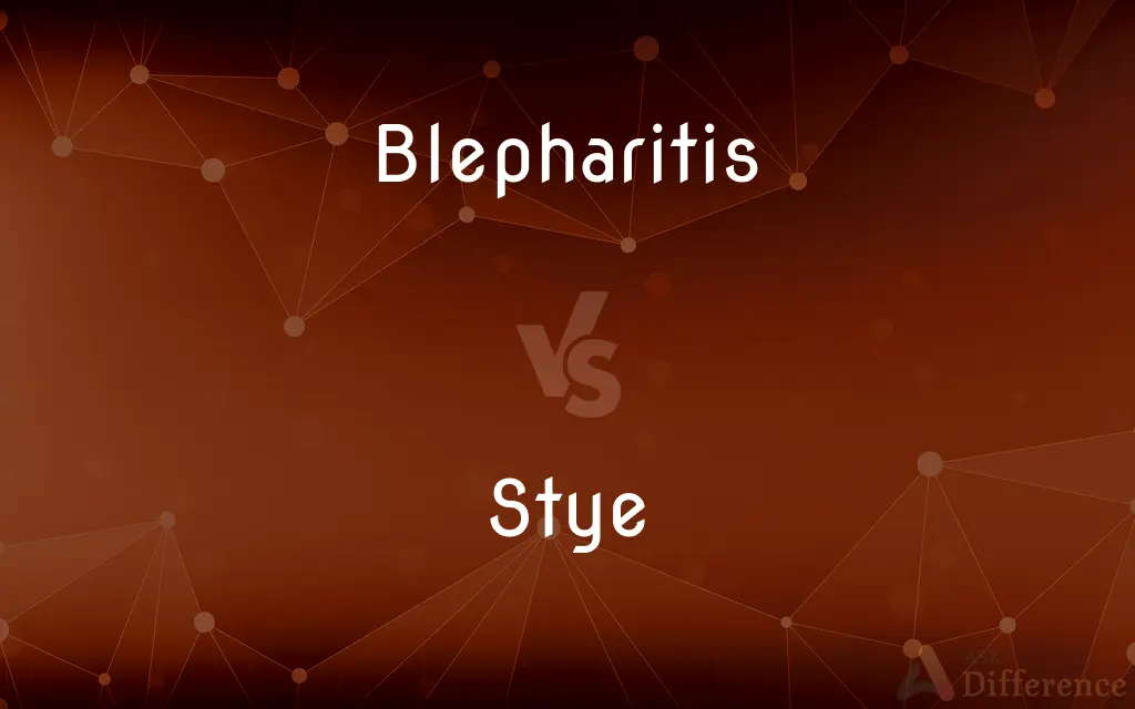 Blepharitis vs. Stye — What's the Difference?