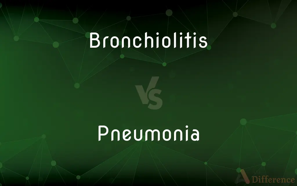 Bronchiolitis vs. Pneumonia — What's the Difference?