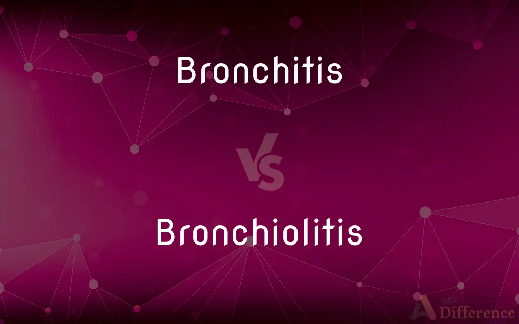 Bronchitis vs. Bronchiolitis — What's the Difference?