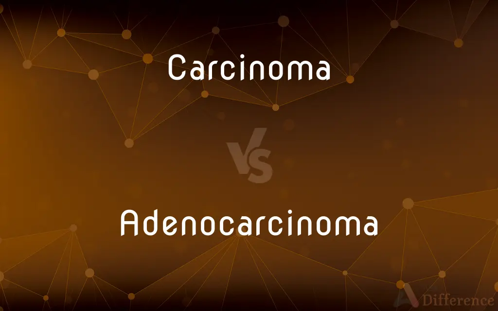 Carcinoma vs. Adenocarcinoma — What's the Difference?