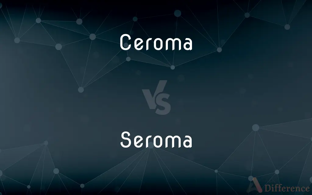 Ceroma vs. Seroma — What's the Difference?