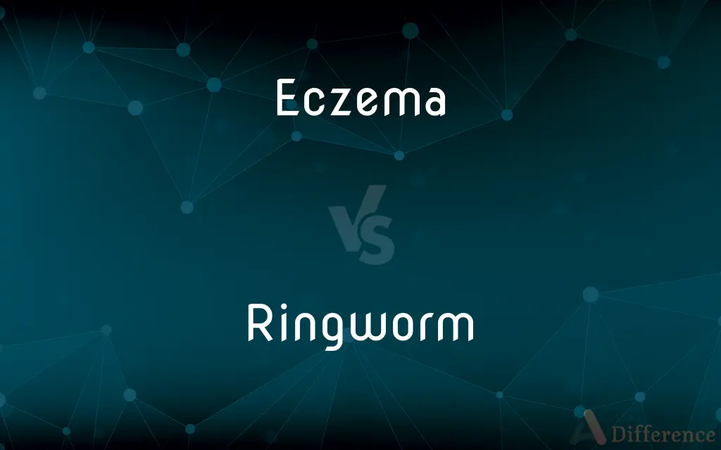 Eczema vs. Ringworm — What's the Difference?