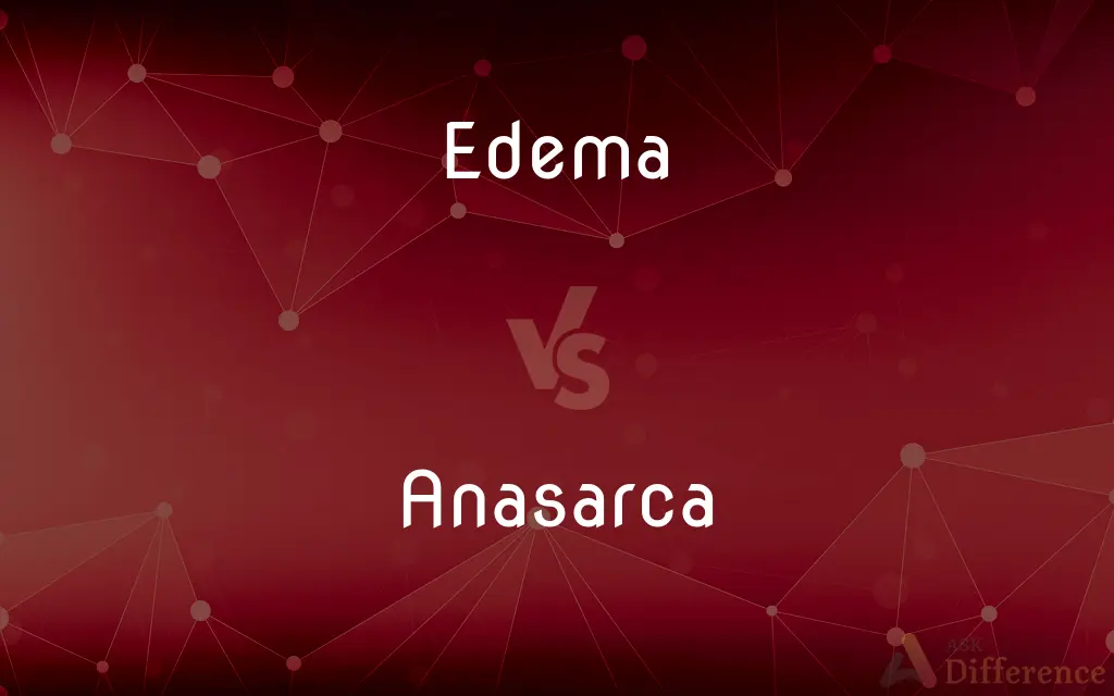 Edema vs. Anasarca — What's the Difference?