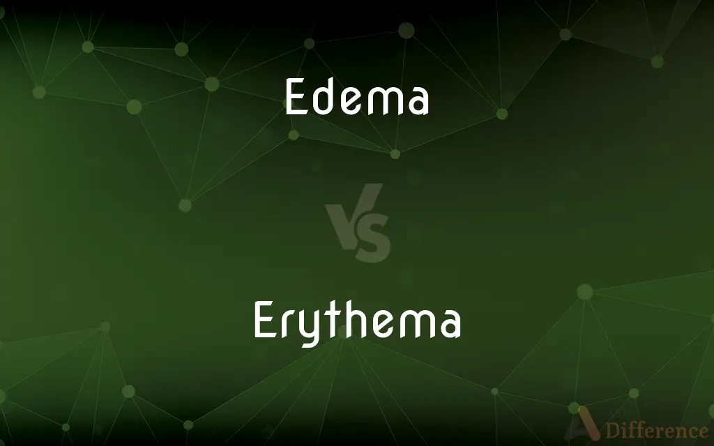 Edema vs. Erythema — What's the Difference?