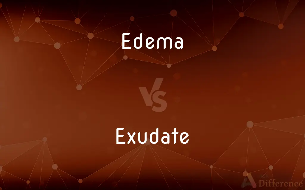 Edema vs. Exudate — What's the Difference?
