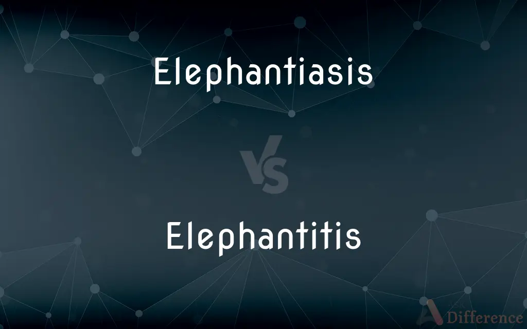 Elephantiasis vs. Elephantitis — What's the Difference?