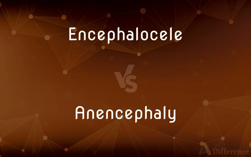 Encephalocele vs. Anencephaly — What's the Difference?