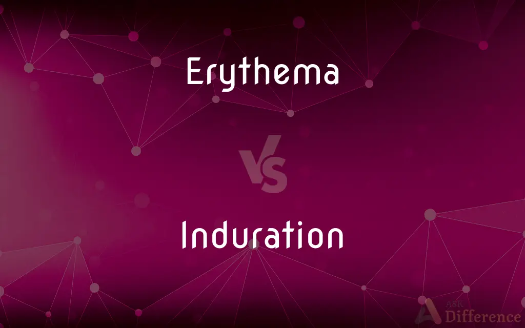Erythema vs. Induration — What's the Difference?