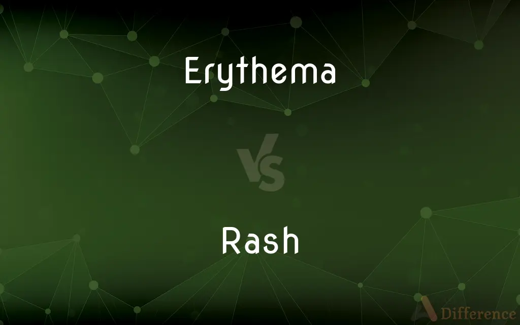 Erythema vs. Rash — What's the Difference?
