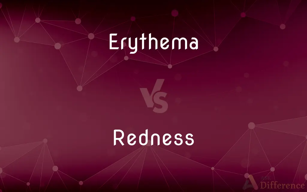 Erythema vs. Redness — What's the Difference?