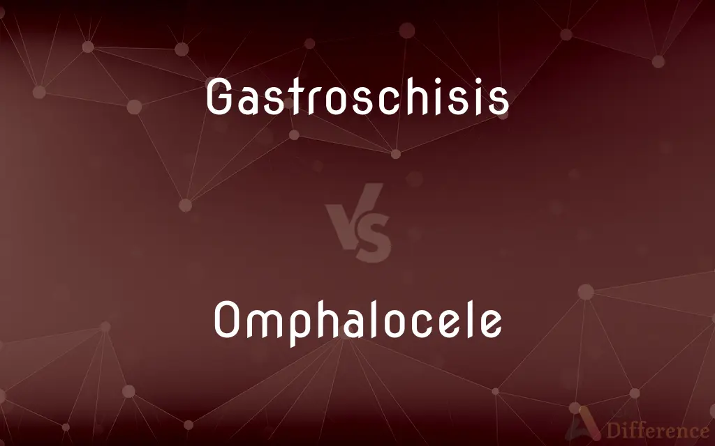 Gastroschisis vs. Omphalocele — What's the Difference?