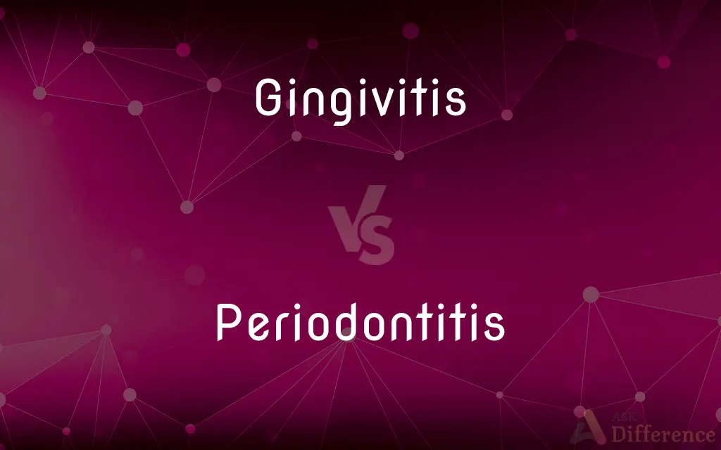 Gingivitis vs. Periodontitis — What's the Difference?