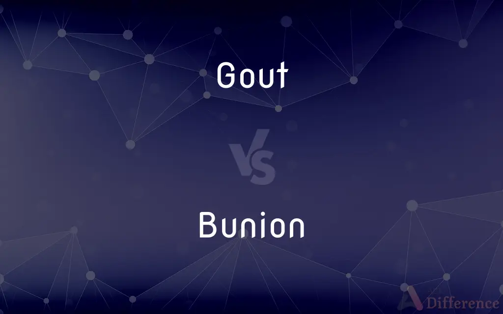 Gout vs. Bunion — What's the Difference?