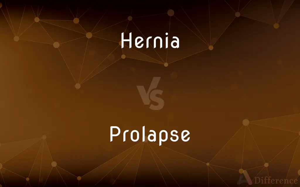 Hernia vs. Prolapse — What's the Difference?