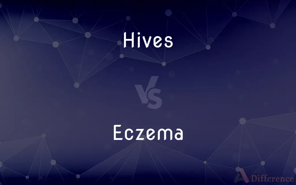Hives vs. Eczema — What's the Difference?