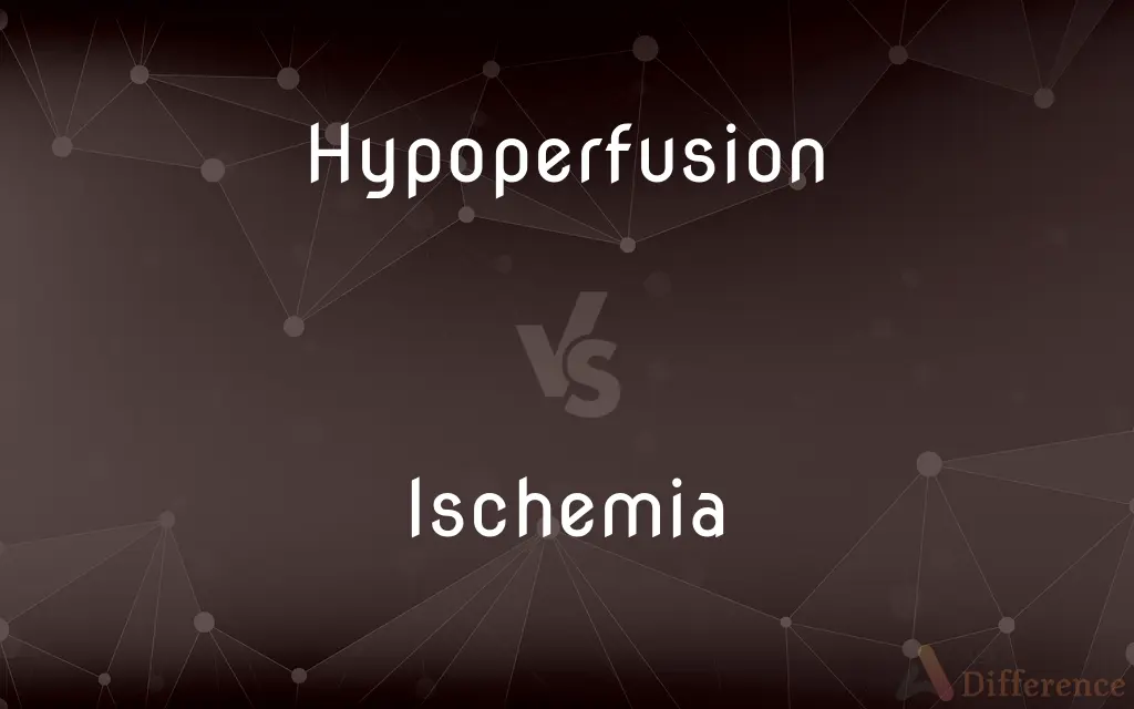 Hypoperfusion vs. Ischemia — What's the Difference?