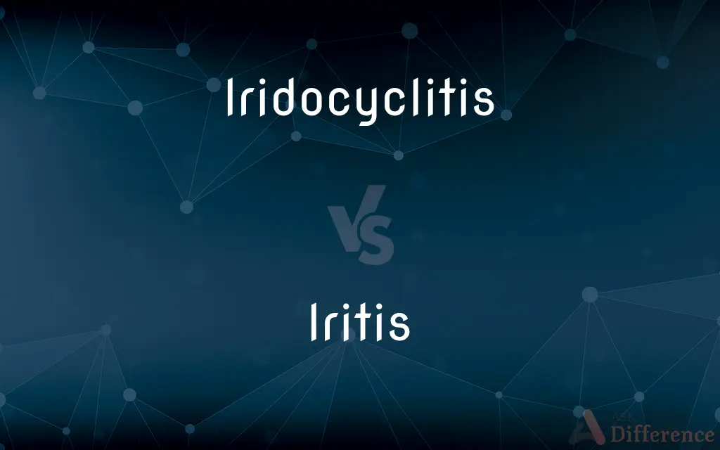 Iridocyclitis vs. Iritis — What's the Difference?