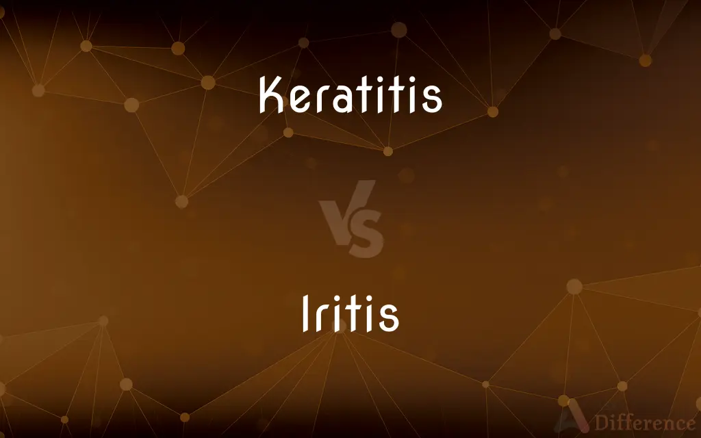 Keratitis vs. Iritis — What's the Difference?