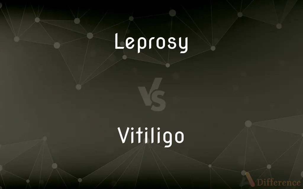 Leprosy vs. Vitiligo — What's the Difference?