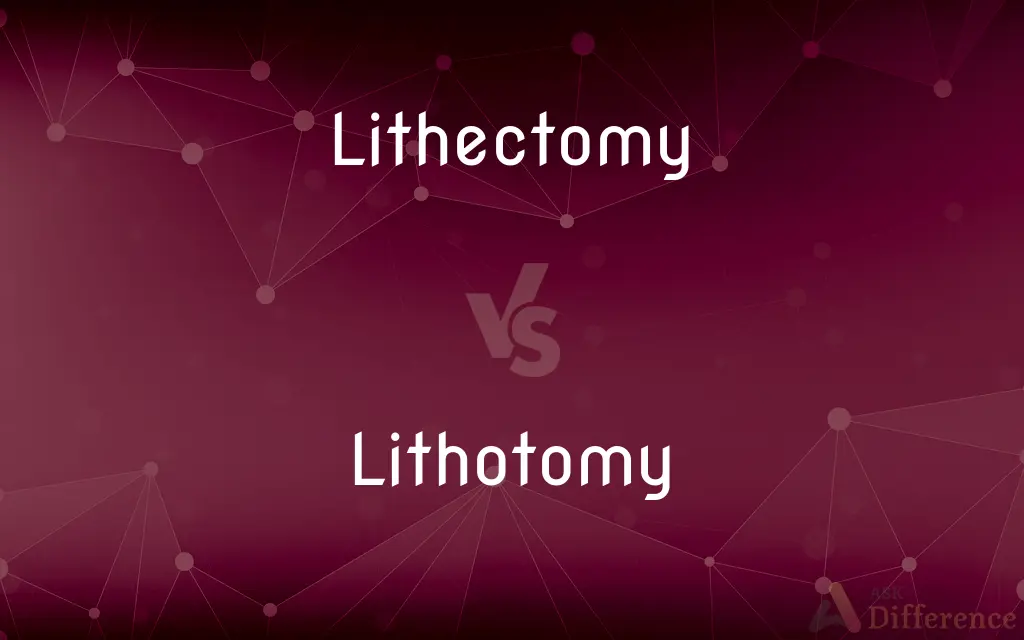 Lithectomy vs. Lithotomy — What's the Difference?