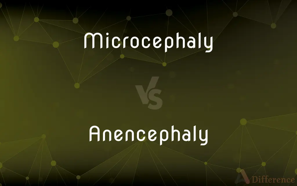 Microcephaly vs. Anencephaly — What's the Difference?