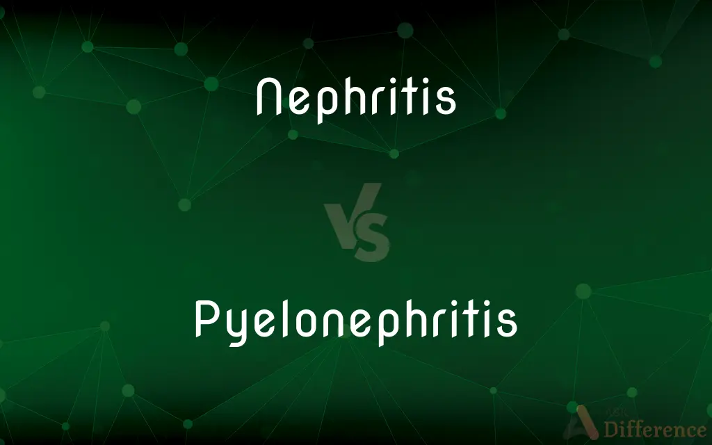 Nephritis vs. Pyelonephritis — What's the Difference?