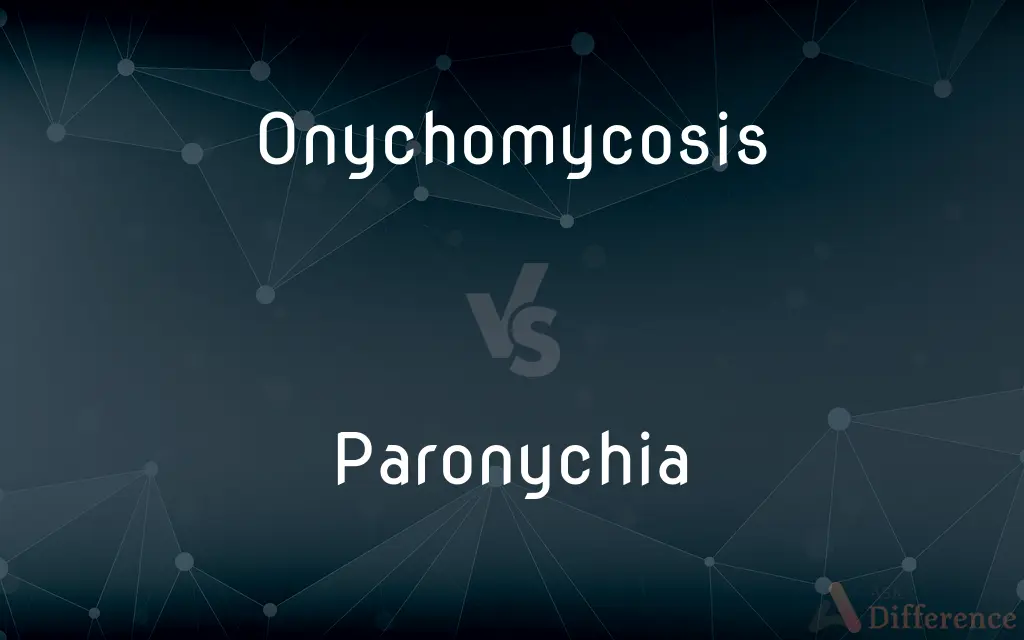 Onychomycosis vs. Paronychia — What's the Difference?