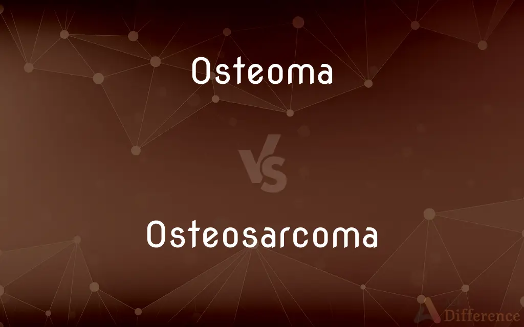 Osteoma vs. Osteosarcoma — What's the Difference?