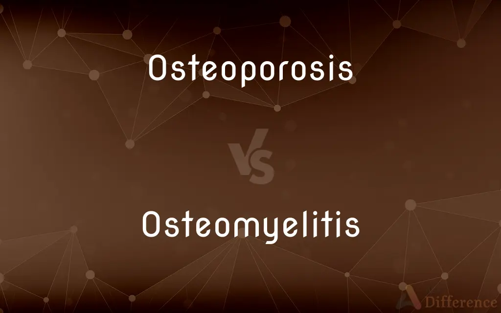 Osteoporosis vs. Osteomyelitis — What's the Difference?