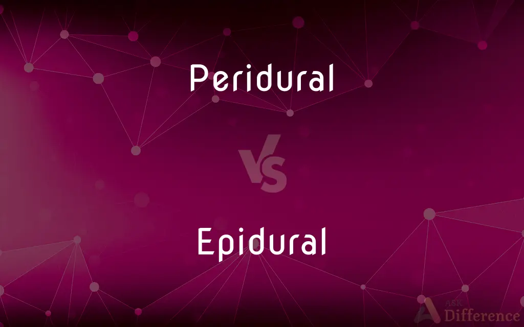 Peridural vs. Epidural — What's the Difference?