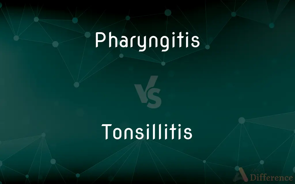 Pharyngitis vs. Tonsillitis — What's the Difference?