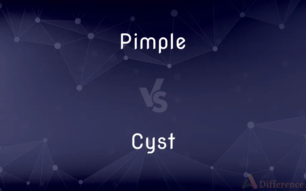 Pimple vs. Cyst — What's the Difference?
