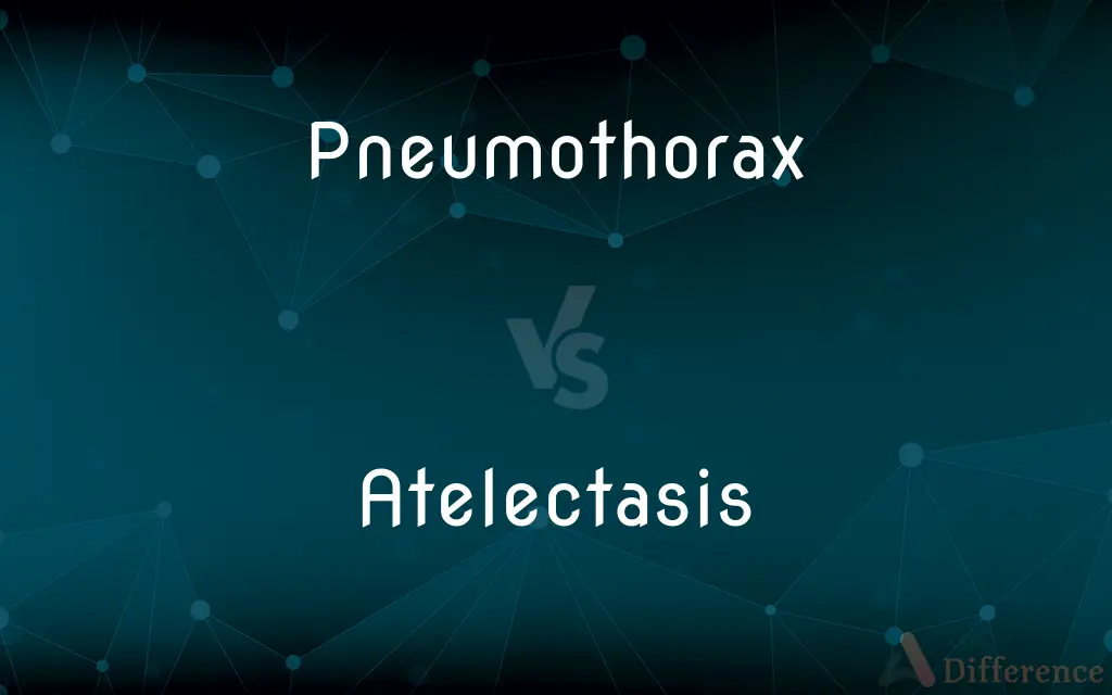 Pneumothorax vs. Atelectasis — What's the Difference?