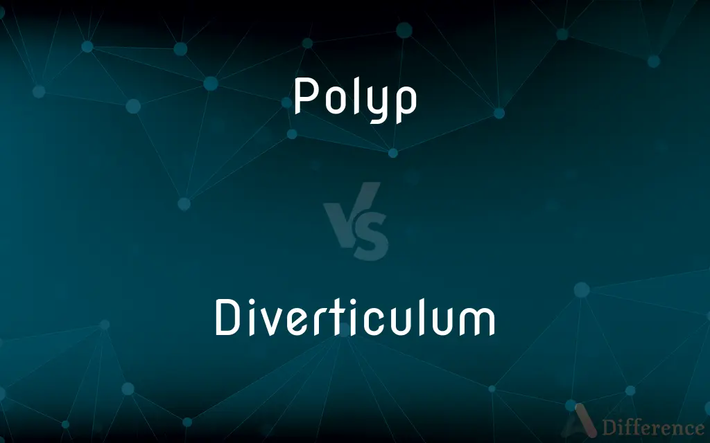 Polyp vs. Diverticulum — What's the Difference?