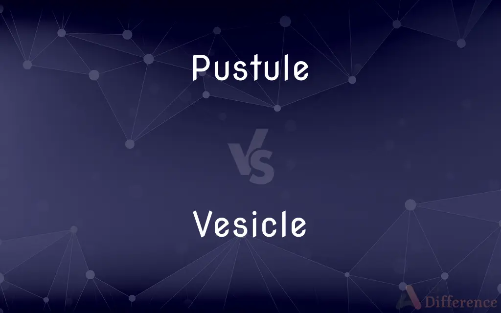Pustule vs. Vesicle — What's the Difference?