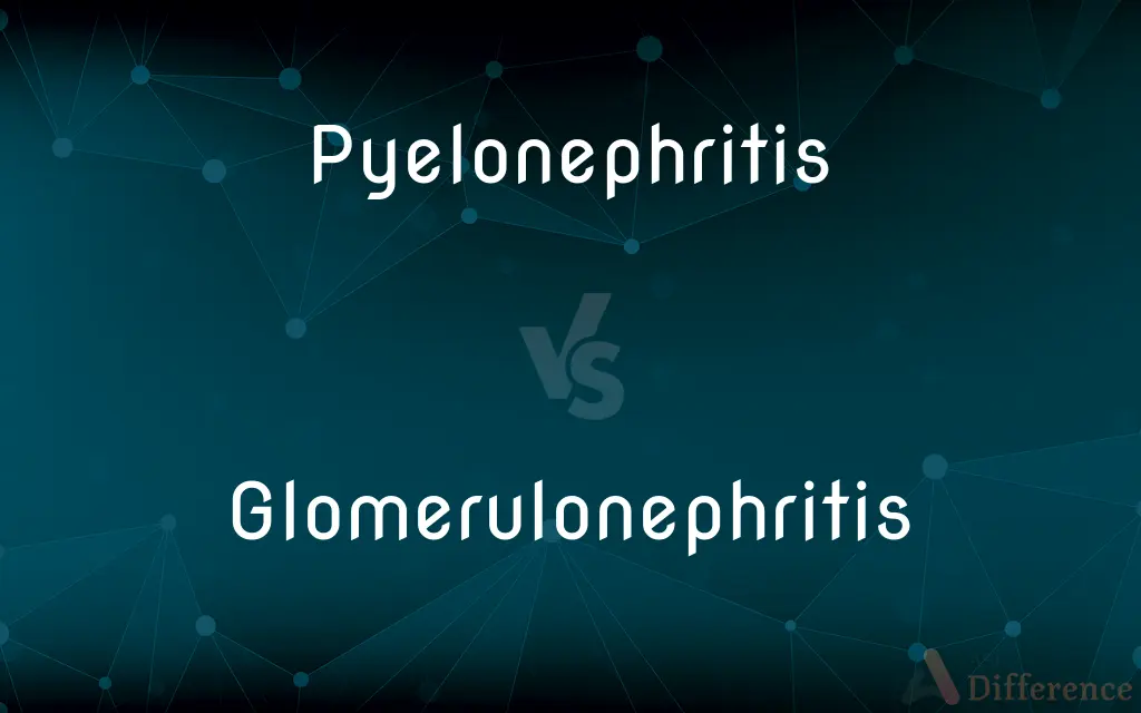 Pyelonephritis vs. Glomerulonephritis — What's the Difference?