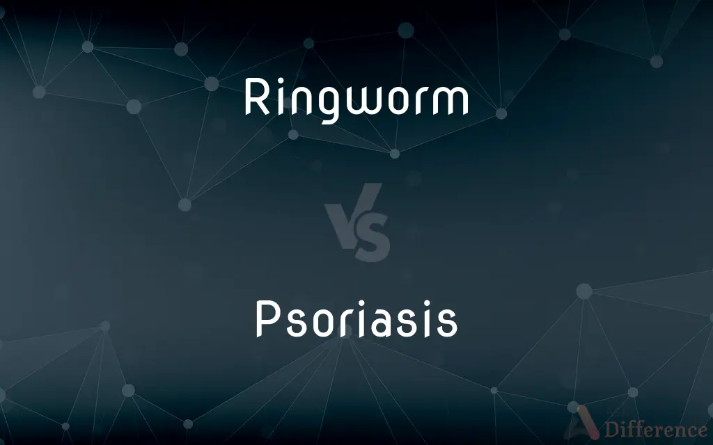 Ringworm vs. Psoriasis — What's the Difference?
