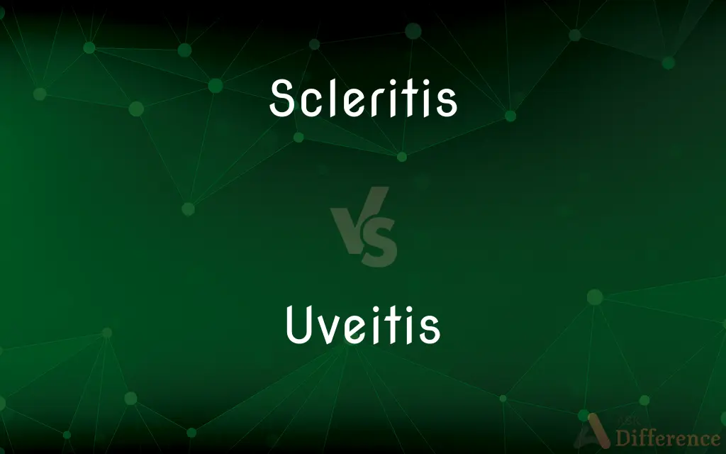Scleritis vs. Uveitis — What's the Difference?