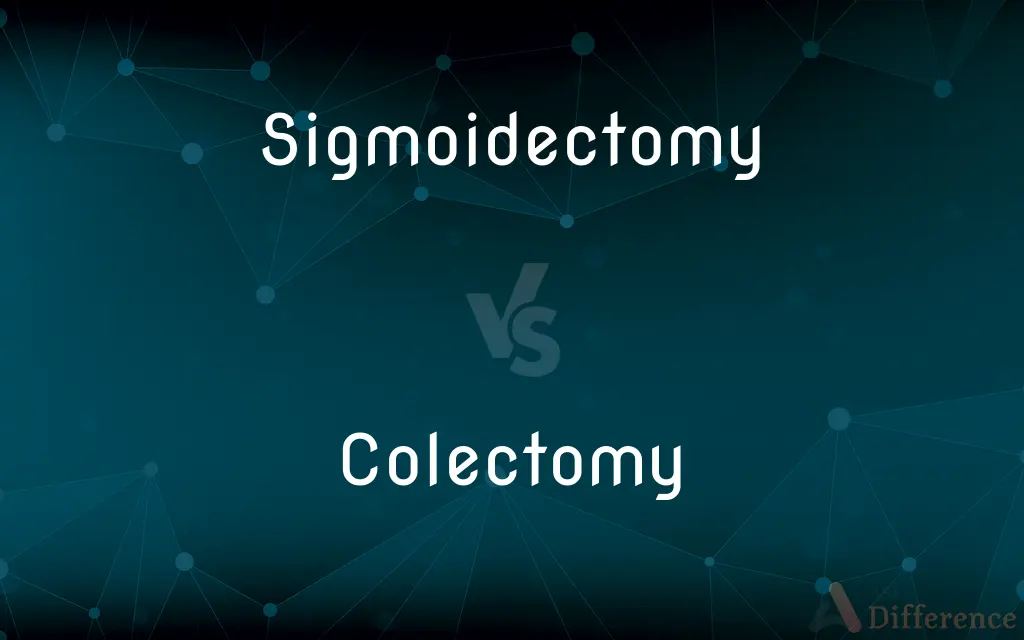 Sigmoidectomy vs. Colectomy — What's the Difference?