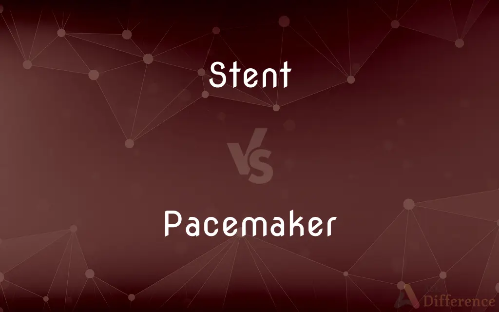Stent vs. Pacemaker — What's the Difference?