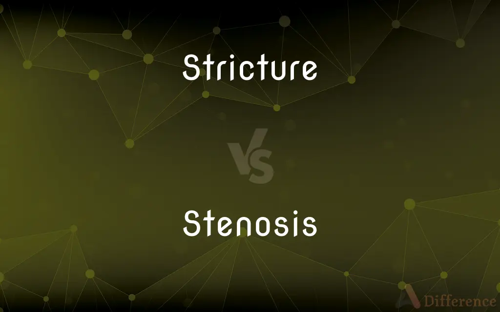 Stricture vs. Stenosis — What's the Difference?