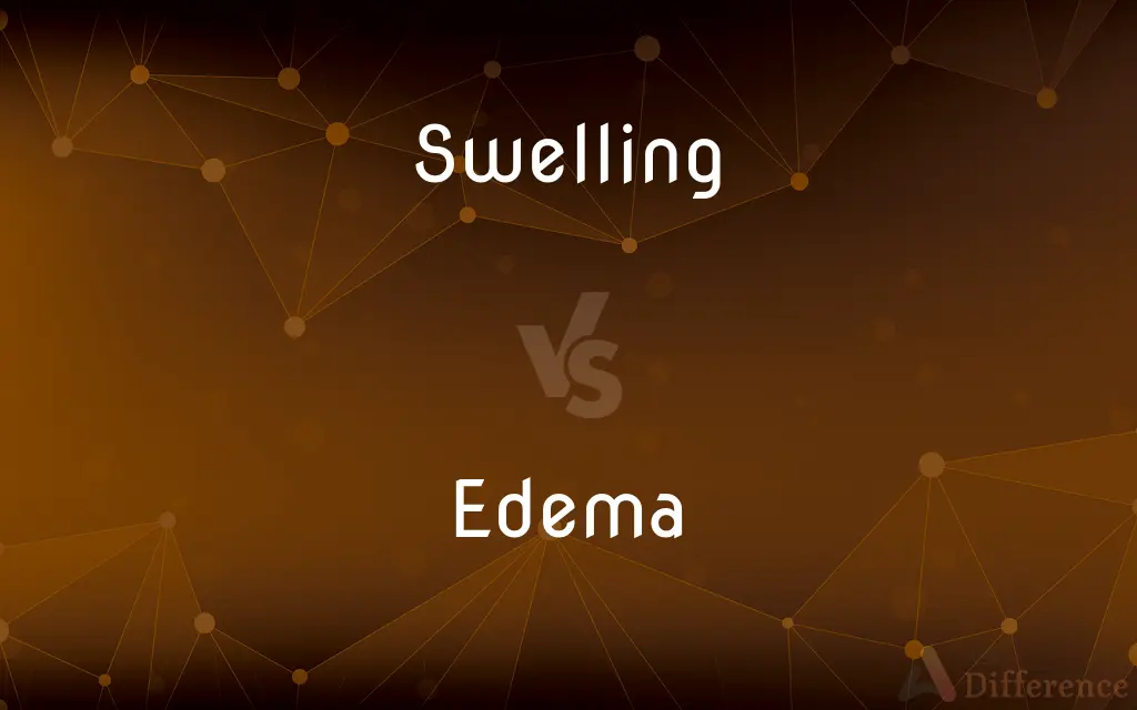 Swelling vs. Edema — What's the Difference?