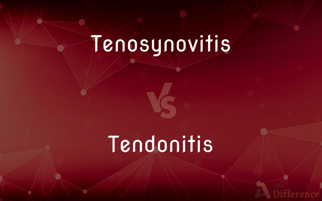 Tenosynovitis vs. Tendonitis — What's the Difference?