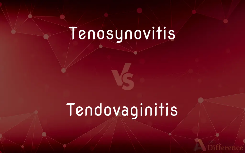 Tenosynovitis vs. Tendovaginitis — What's the Difference?
