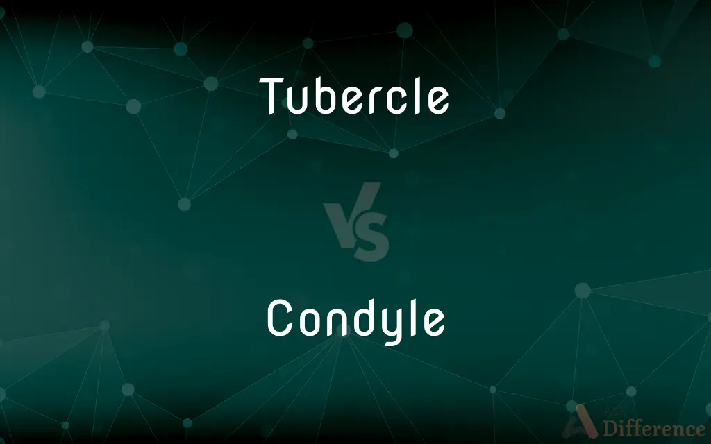 Tubercle vs. Condyle — What's the Difference?