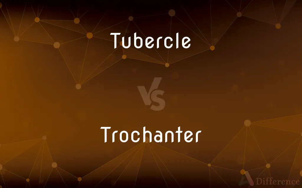 Tubercle vs. Trochanter — What's the Difference?