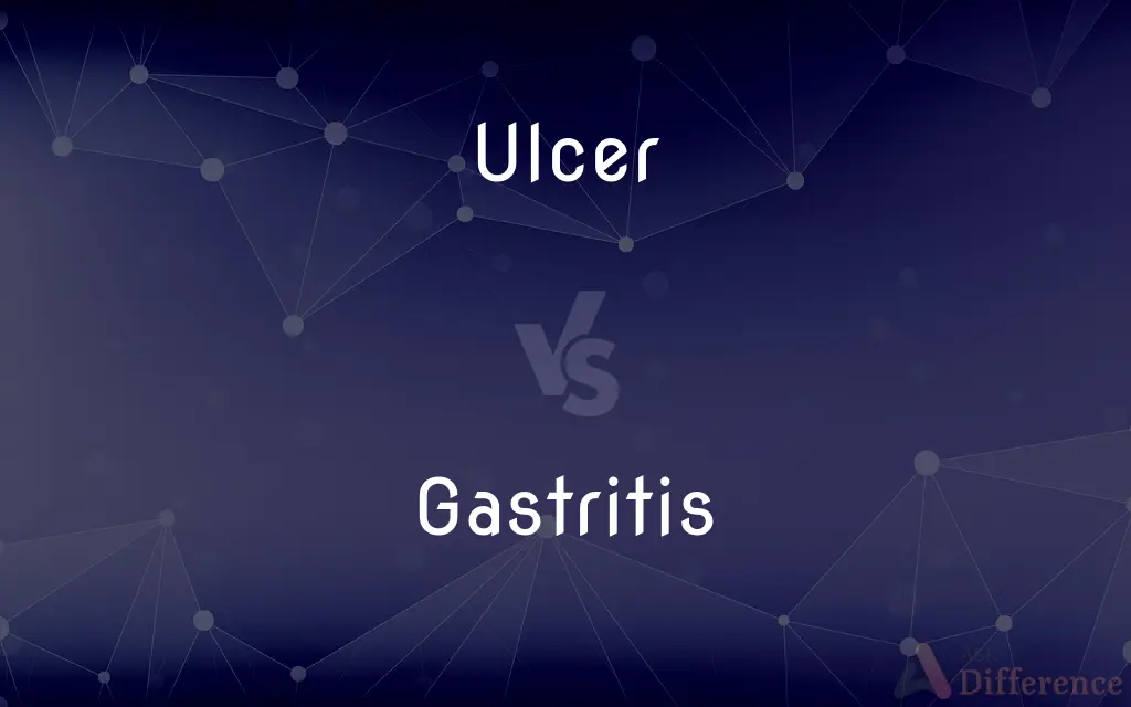 Ulcer vs. Gastritis — What's the Difference?