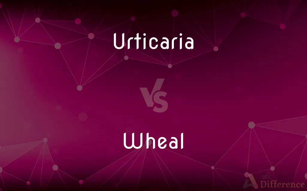 Urticaria vs. Wheal — What's the Difference?